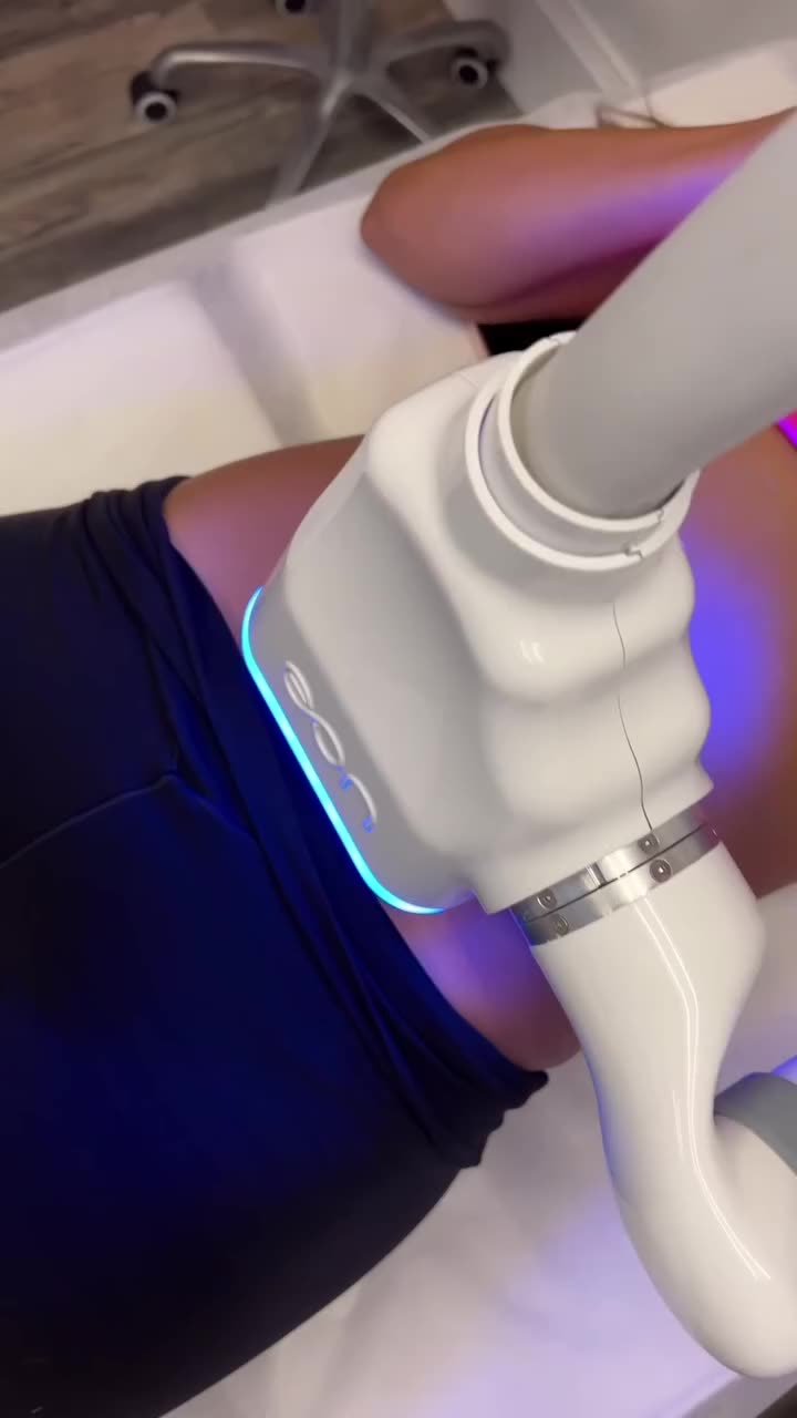 The EON robotic handpiece glowing blue as it treats a client's flank at Beauty Bungalow
